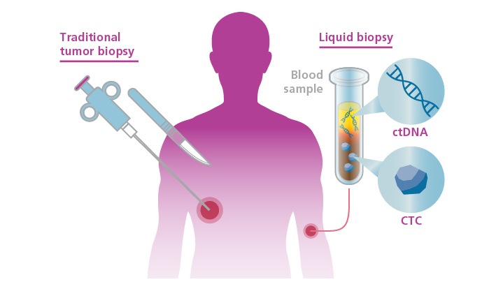 img-Early Detection Progress And Challenges