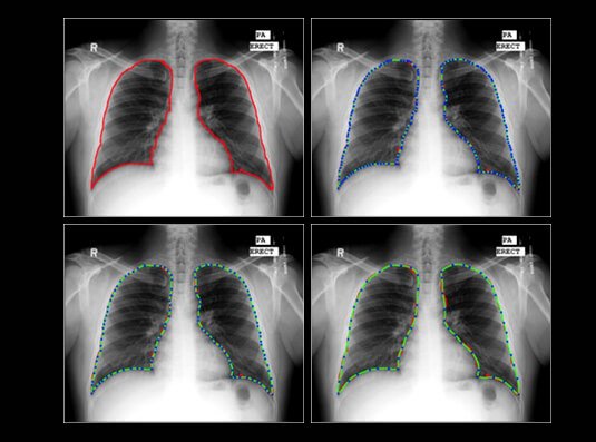 img-AI in Medical Imaging